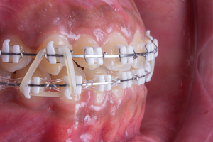 Odontologia 4.0 Ortodontia
