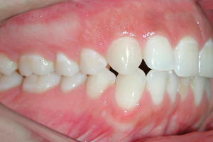 Ortodontia: uma vida repleta de sorrisos?