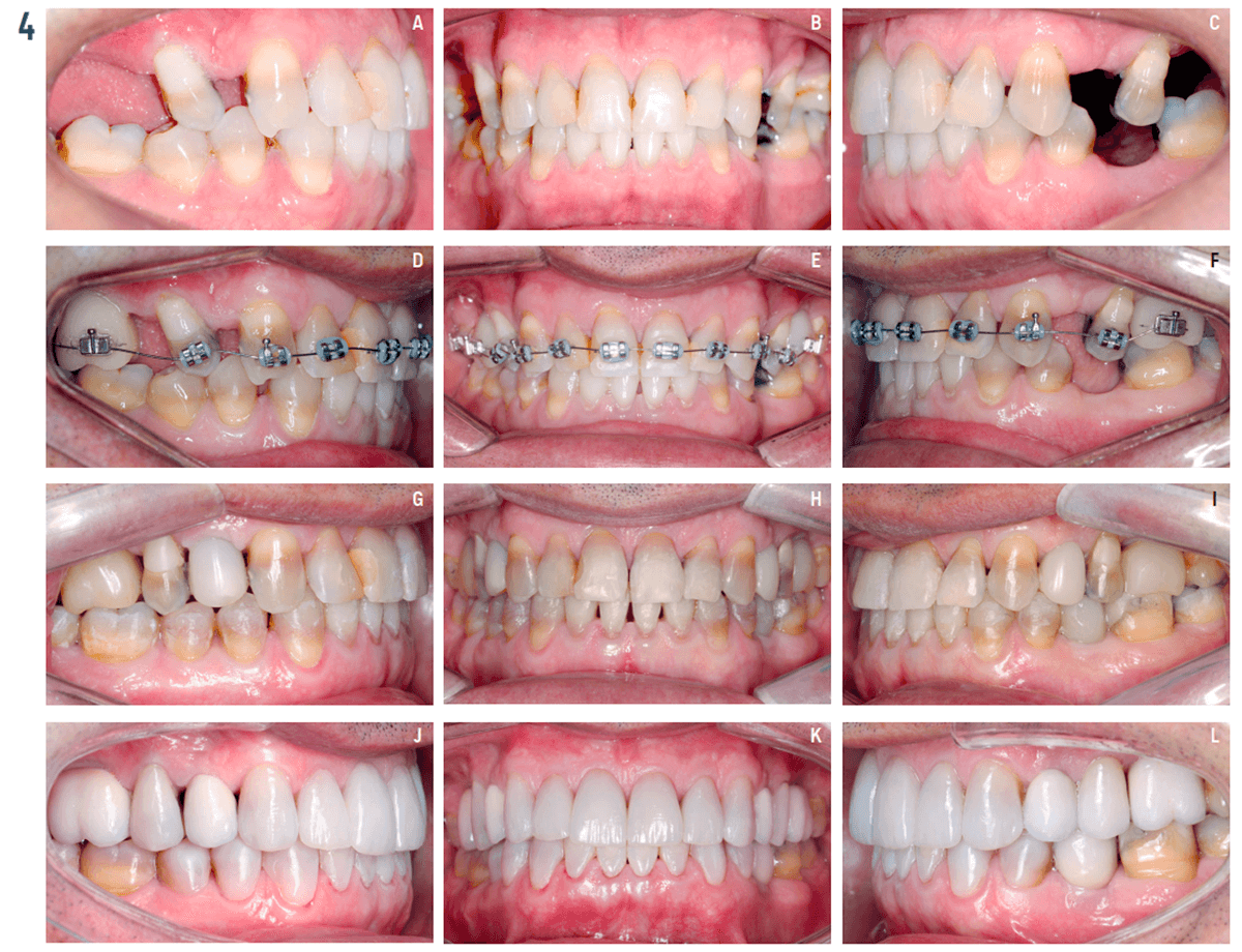 O protagonismo da Ortodontia contemporânea na Odontologia integrada