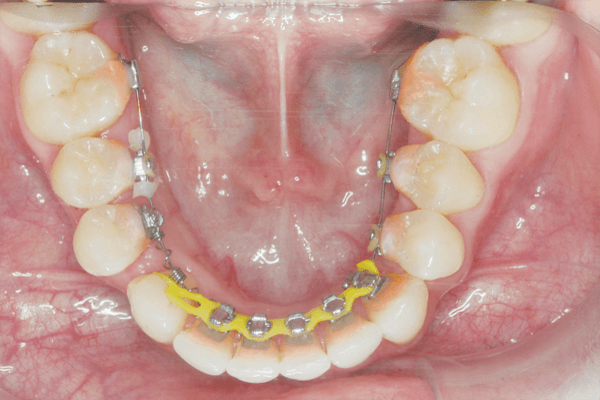 Lucratividade em Ortodontia Estética
