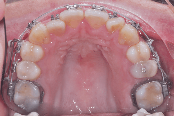 Cirurgia de ATM e Tratamentos Alternativos