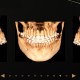 Excelência em Odontologia: diagnóstico tridimensional em Ortodontia